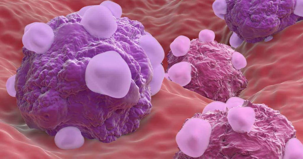 tratamiento para linfoma difuso de células B grandes